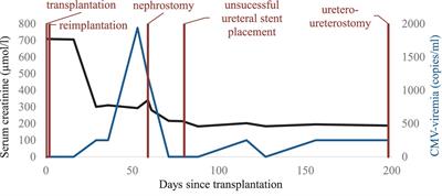 Acute post-renal kidney graft dysfunction due to cytomegalovirus-positive nephrogenic adenoma—case report and review of the literature